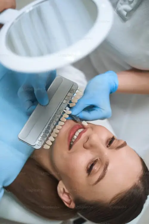 Professional teeth whitening