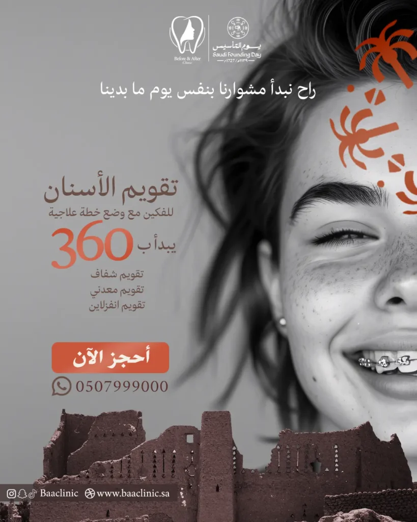تقويم الأسنان للفكين مع وضع خطة علاجية يبدأ بـ 360 ريال تقويم شفاف - تقويم معدني - تقويم انفزلاين