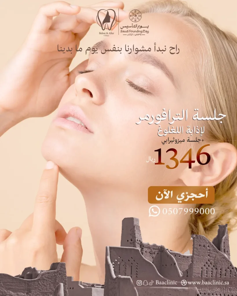 جلسة الترافورمر لإذابة اللغلوغ + جلسة ميزوثيرابي 1346 ريال فقط