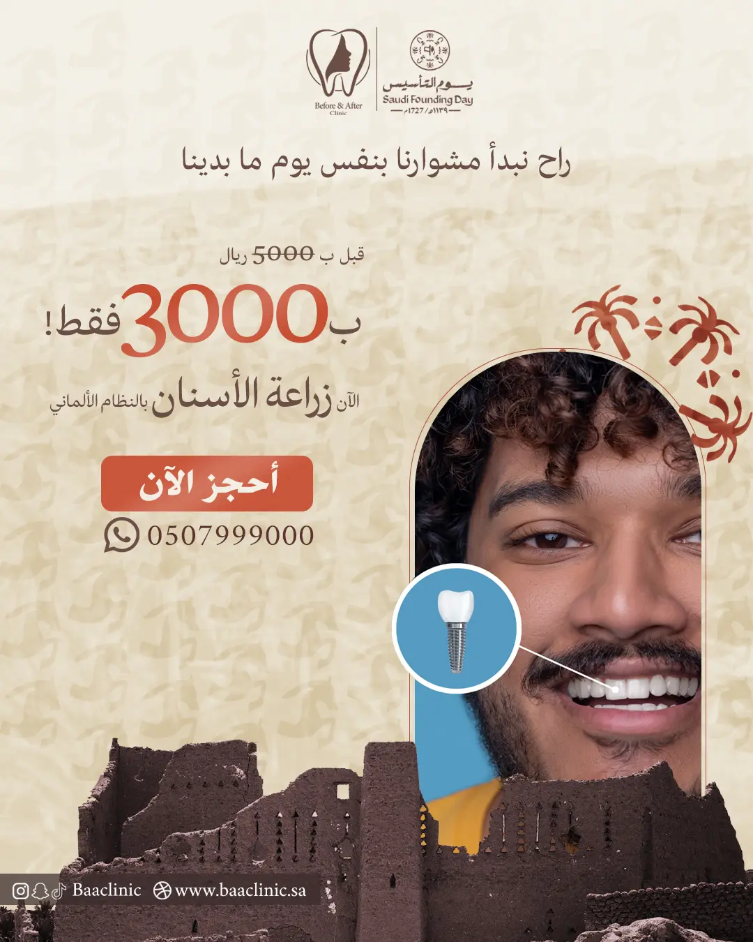 بـ 3000 ريال فقط! الآن زراعة الأسنان بالنظام الألماني